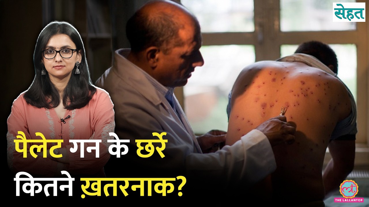 Pellet Gun शरीर में परमानेंट डैमेज कर सकती है, डॉक्टर से सब सुन लें | CJP Protest | Sehat 1426