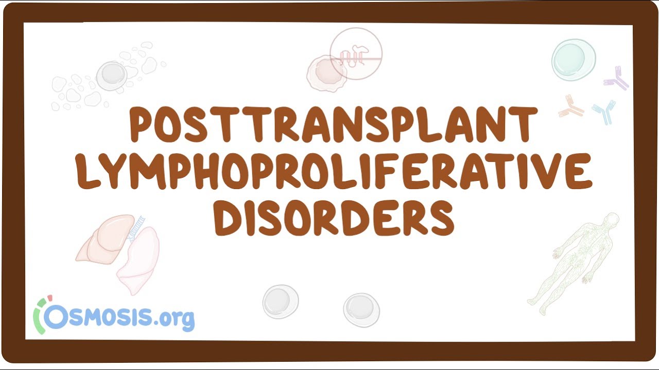 Posttransplant lymphoproliferative disorders - causes, symptoms, diagnosis, treatment, pathology