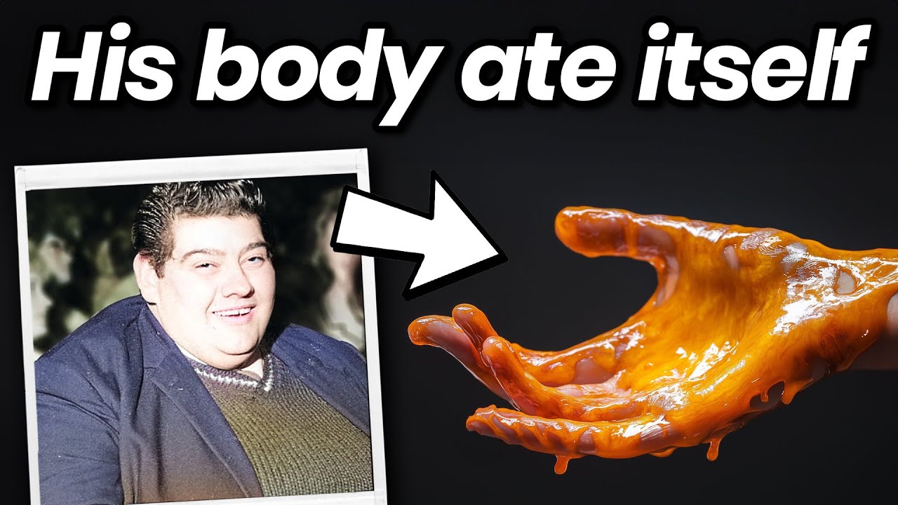 The Man Who Let His Body Eat Itself