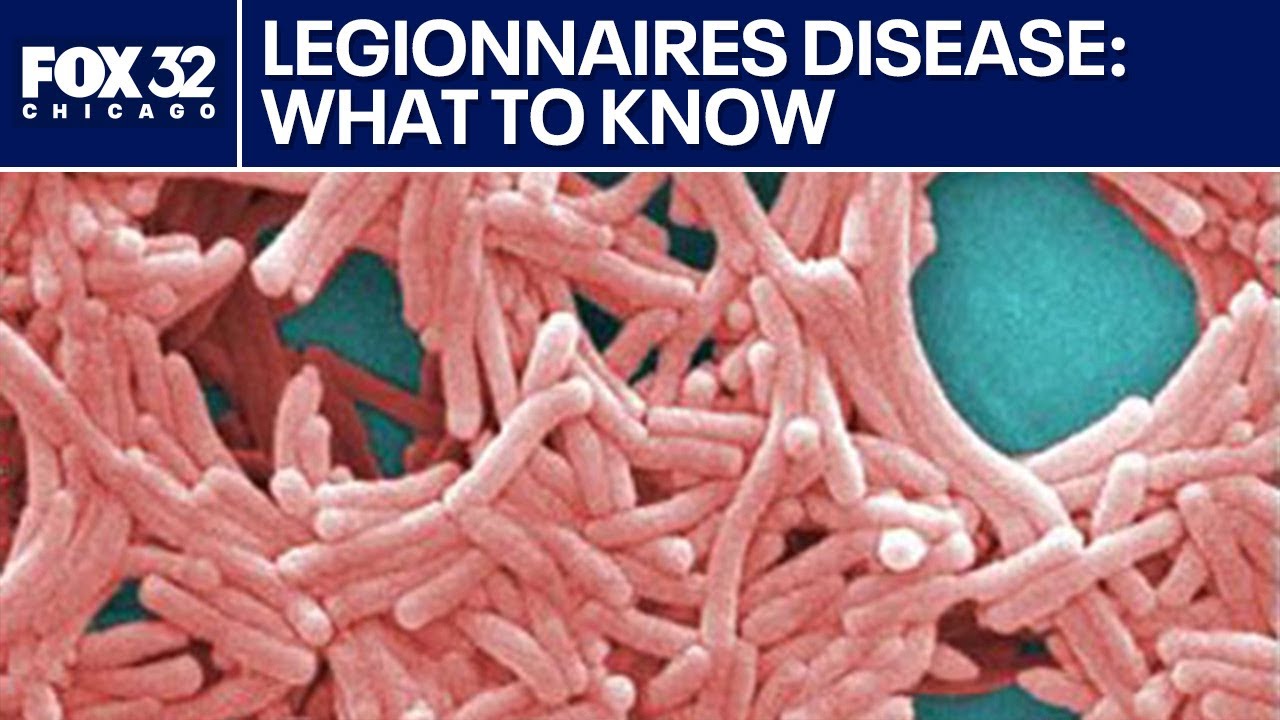 Legionnaires' disease: symptoms, transmission & who is at risk | ChicagoNOW