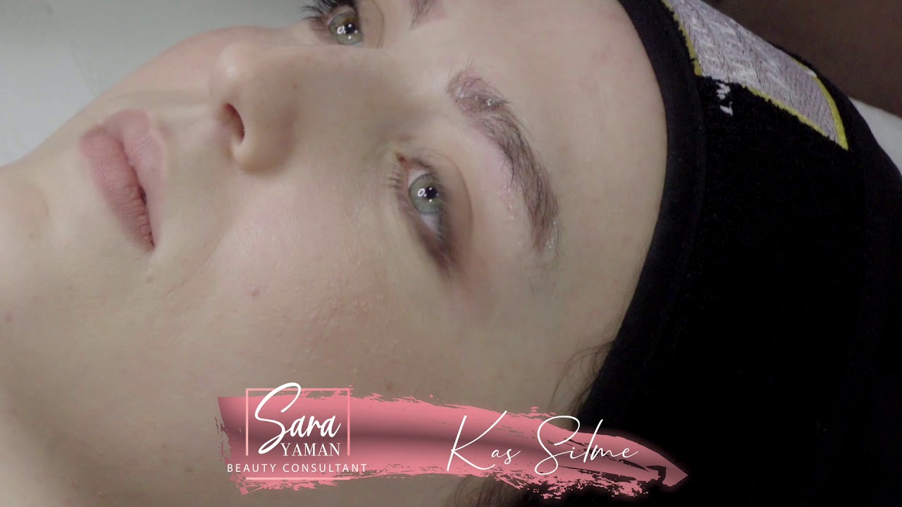 Uzm. Est. Sara Yaman | Kaş Silme İşlemi