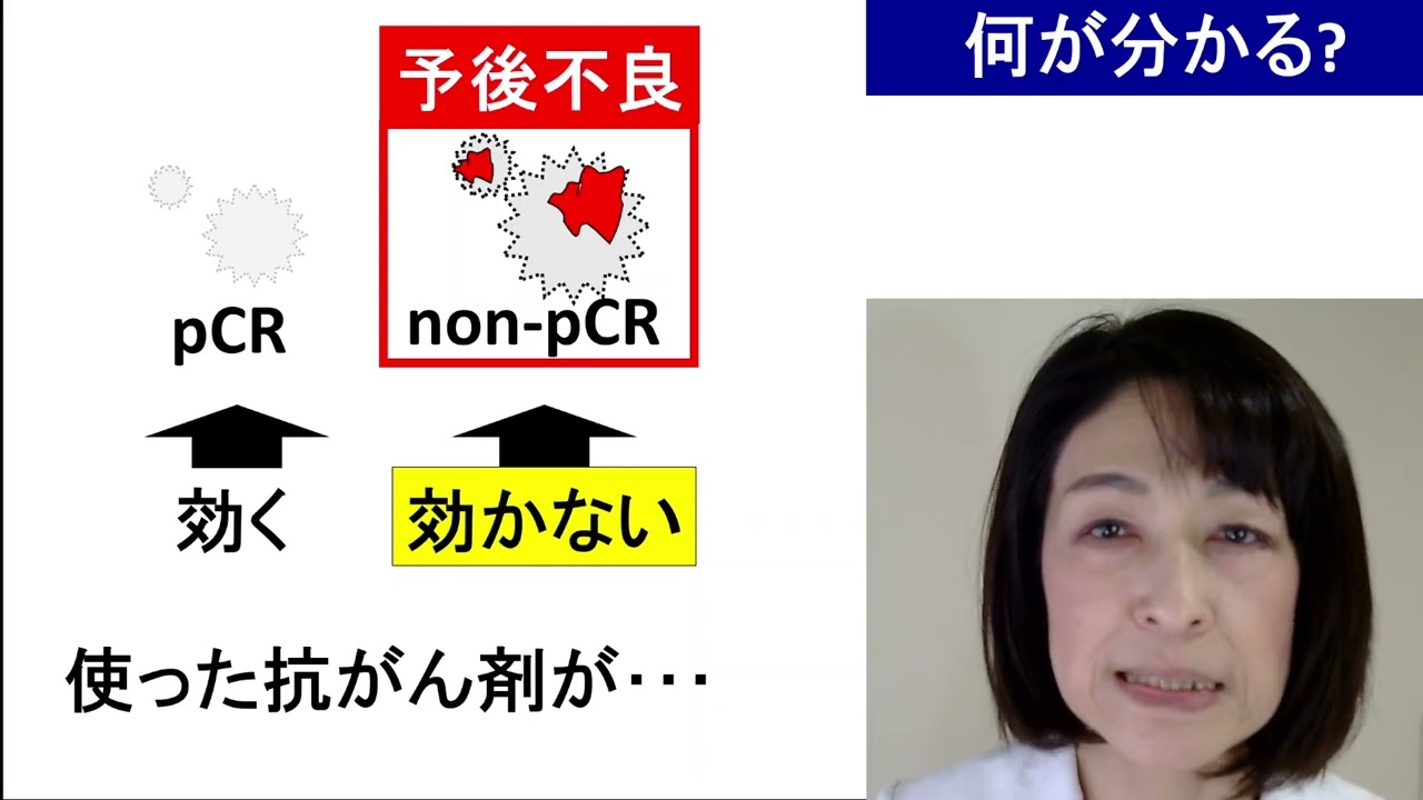 術前化学療法（NAC）の本当の意義