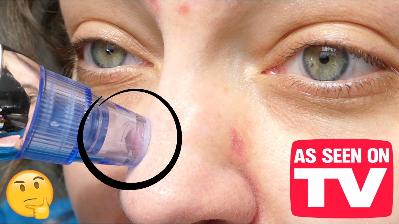 Do Pore Vacuums ACTUALLY Work?? | DERMASUCTION Pore Cleaning Device (Testing + Review)