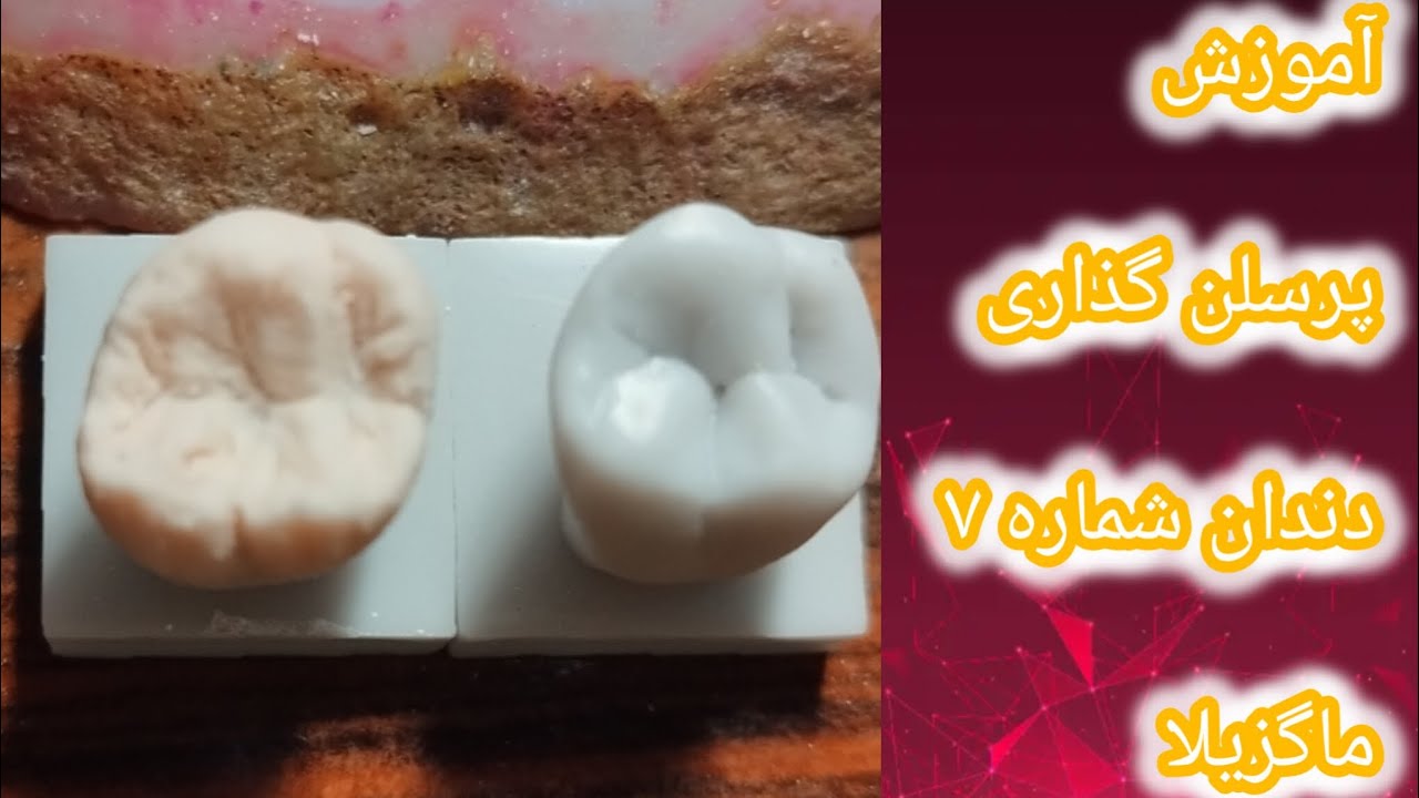 🔥آموزش کامل پرسلن گذاری دندان ۷ ماگزیلا👩🏼‍⚕️ | آناتومی کامل همراه با مراحل پودرگذاری در دندانسازی🖌️🦷