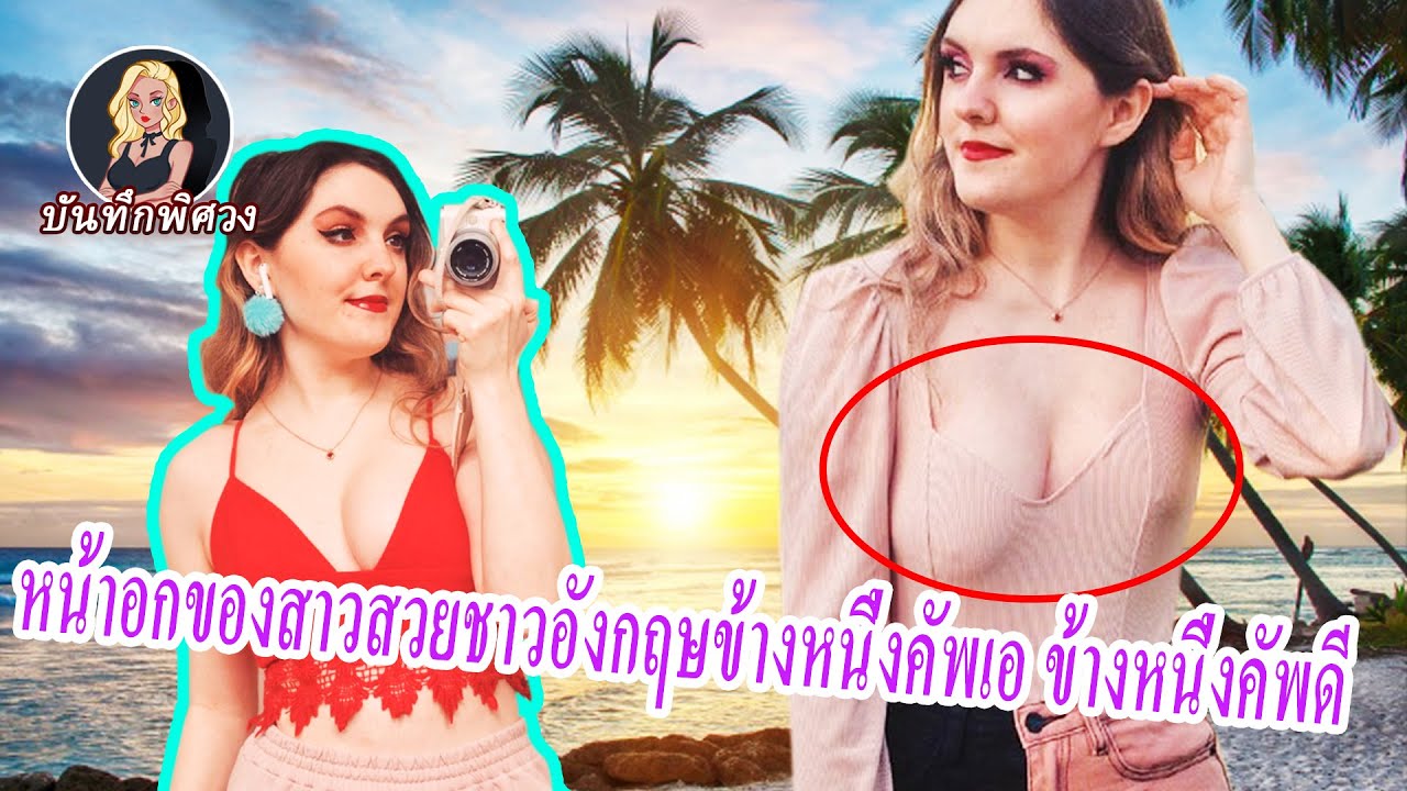หน้าอกของสาวสวยชาวอังกฤษ “ซ้ายคัพเอ ขวาคัพดี” ถูกหัวเราะเยาะมาเป็ฯ 10 ปี สุดท้ายพบว่าเป็นโรคหายาก?