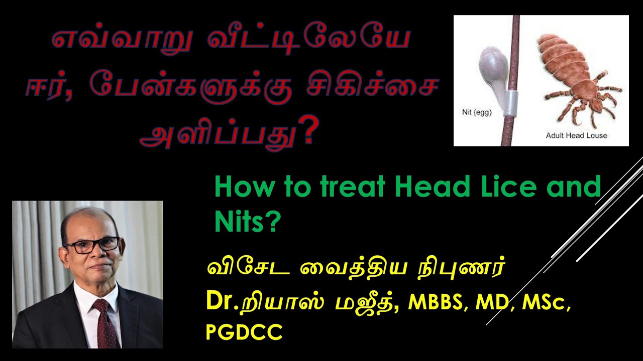 How to treat Head Lice and  Nits | தலையில் உள்ள பேன், ஈர் குணமாக்குவது எப்படி  | Dr. Riyaz Majeed