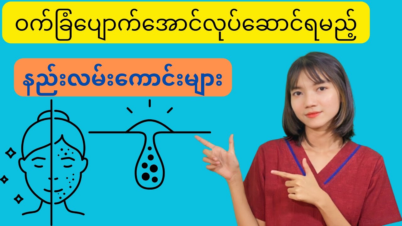 ဝက်ခြံမဖြစ်အောင်ဒီလိုနည်းလမ်းတွေနဲ့ကာကွယ်ကြည့်ပါ - Acne Care