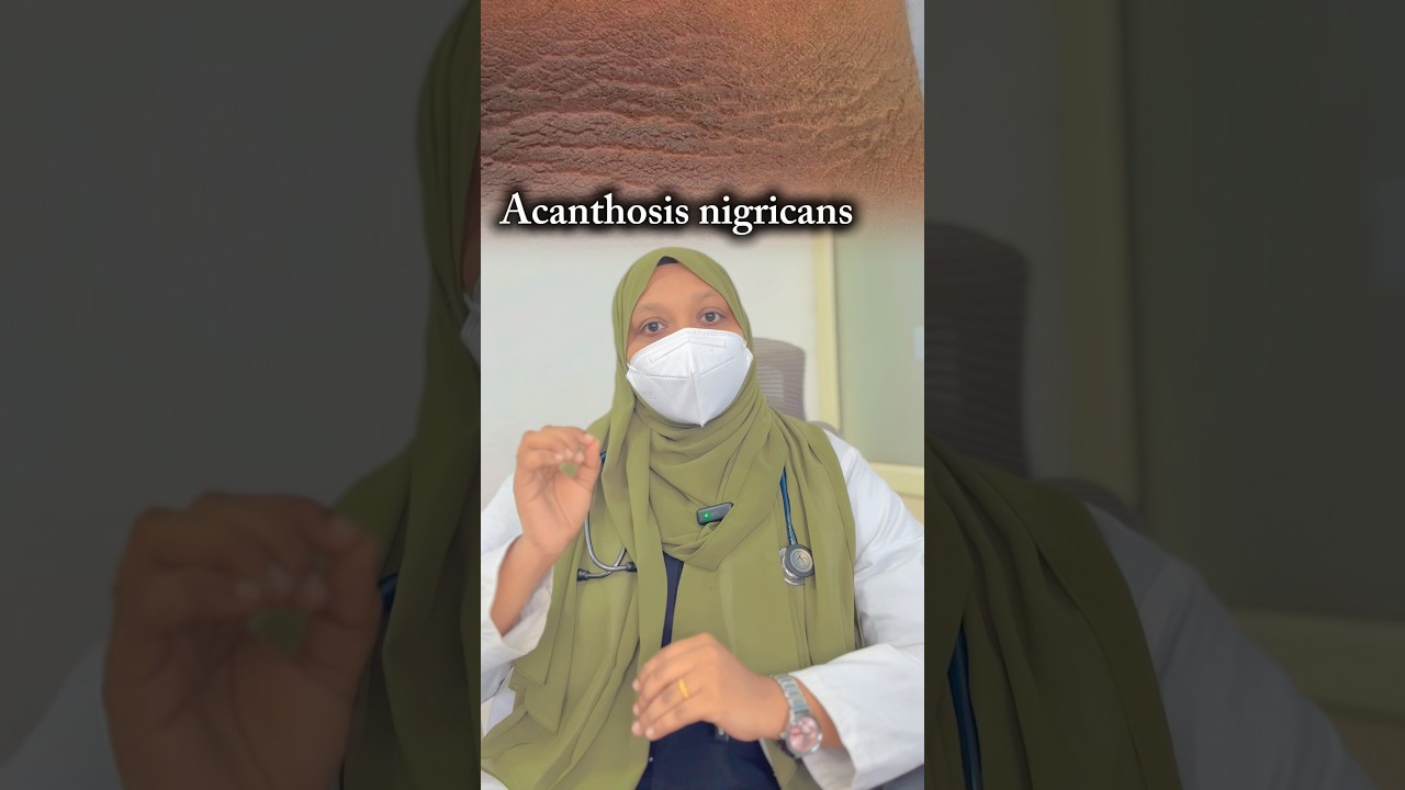 #AcanthosisNigricans #DarkNeckSolution #HealthyLifestyleChanges #InsulinResistanceCare