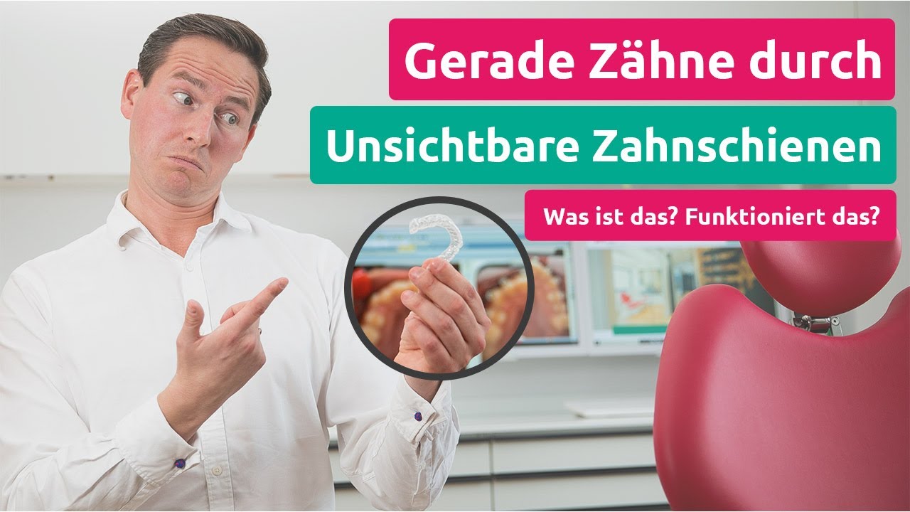Unsichtbare Zahnschienen bzw. Aligner? Was ist das und funktioniert das, um gerade Zähne zubekommen?
