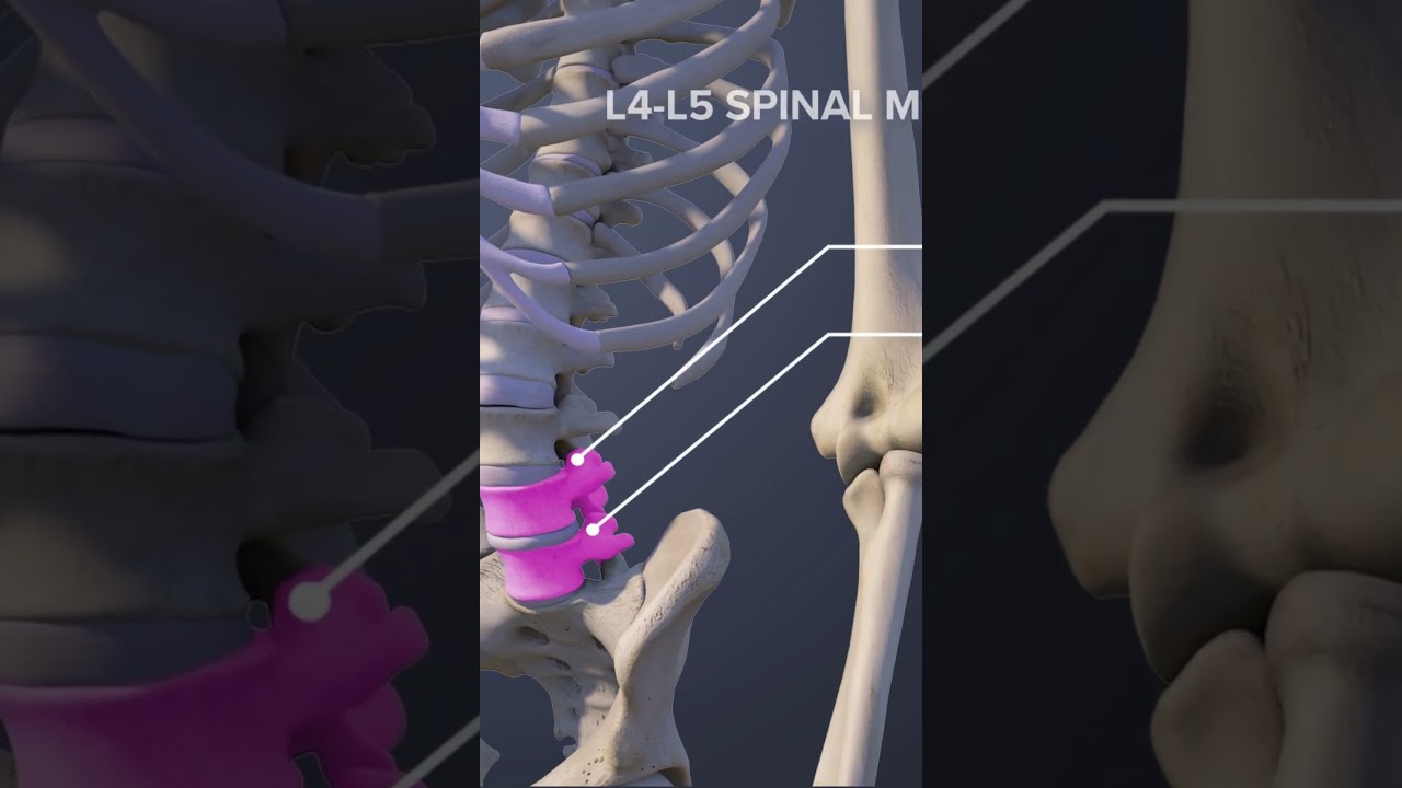 The L4-L5 Spinal Motion Segment