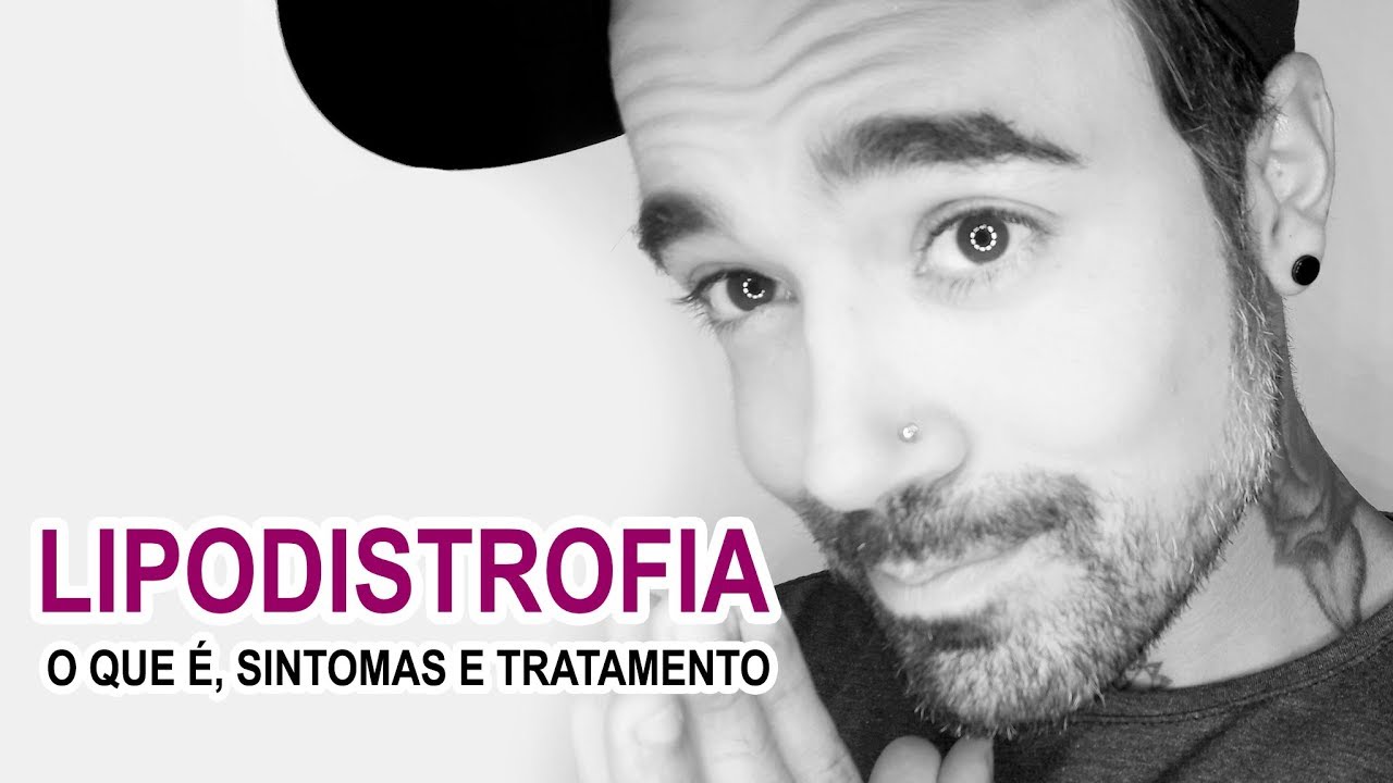 HIV/AIDS - LIPODISTROFIA - O QUE É, SINTOMAS E TRATAMENTO | Léo Cezimbra