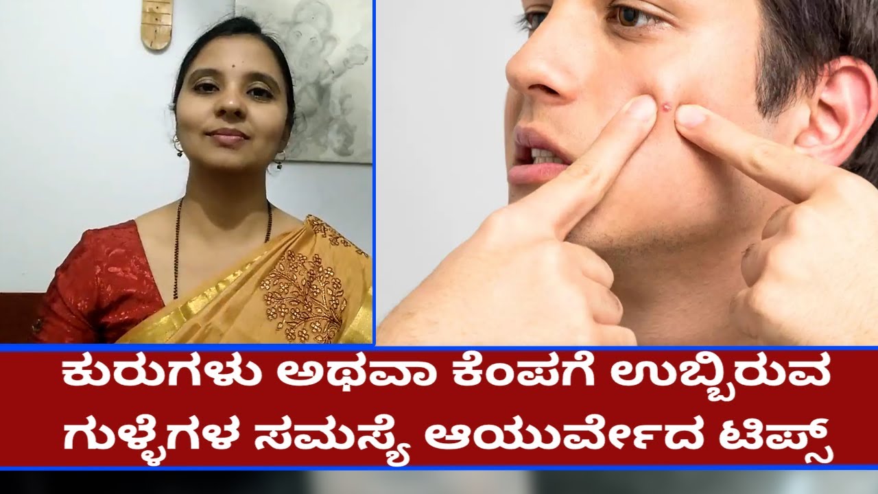 ಕುರುಗಳು ಅಥವಾ ಕೆಂಪಗೆ ಉಬ್ಬಿರುವ ಗುಳ್ಳೆಗಳ ಸಮಸ್ಯೆ ಆಯುರ್ವೇದ ಟಿಪ್ಸ್  | Vijay Karnataka
