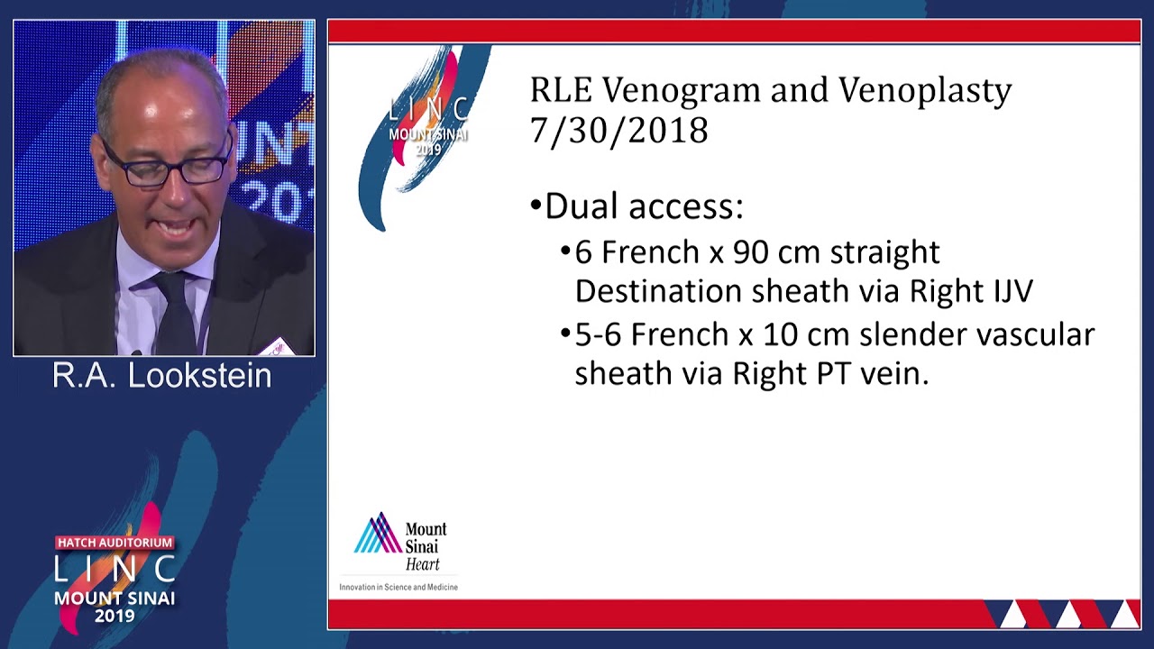 Hatch D1- Is There Any Role for Endovascular Therapy for Femoral-Popliteal DVT? - Dr. Lookstein