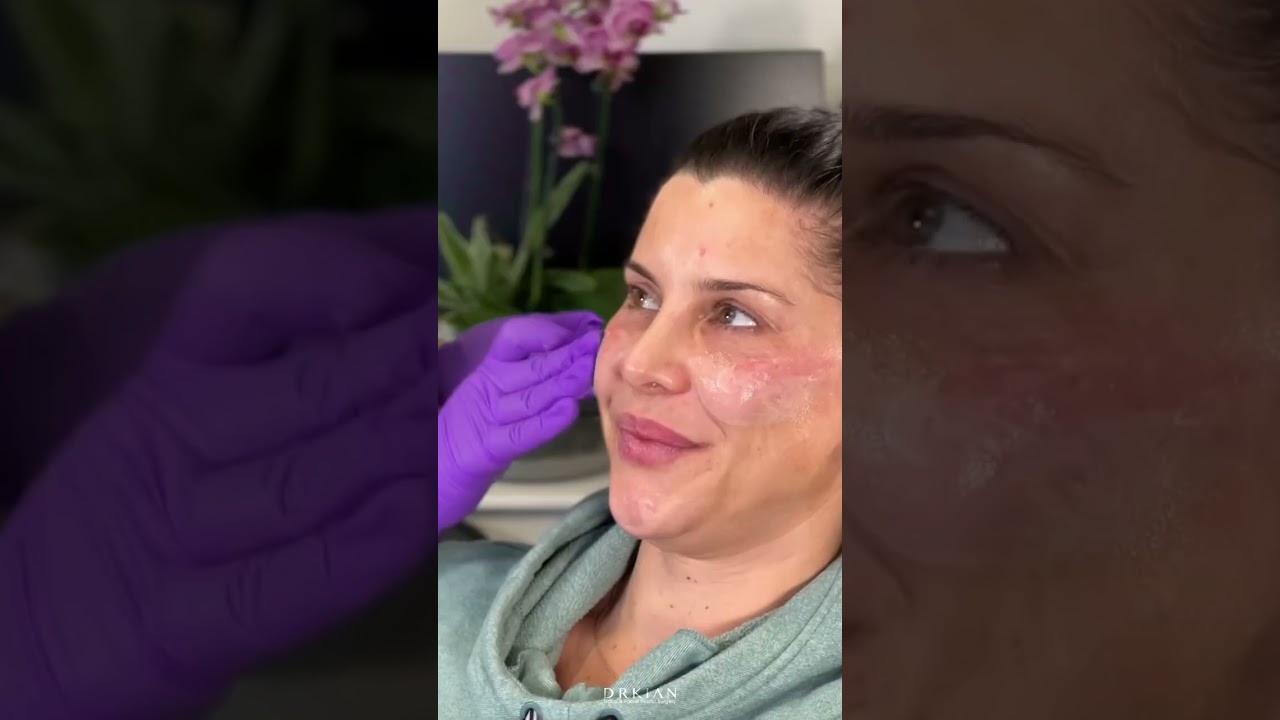 How CBD Has Changed My Plastic Surgery Practice | Dr. Kian