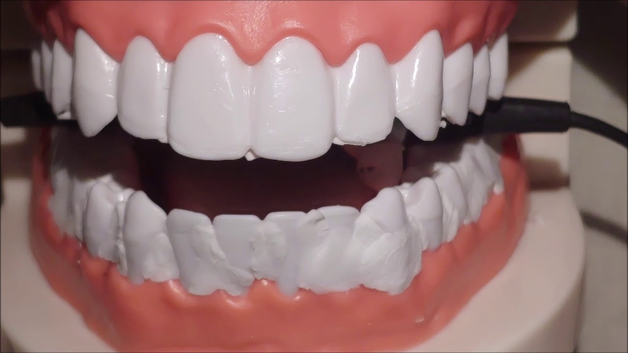 치아 스케일링 ASMR ll 치석제거 ASMR ll Dental Clinic ASMR ll No talking ll 자막O ll Eng,Kor sub