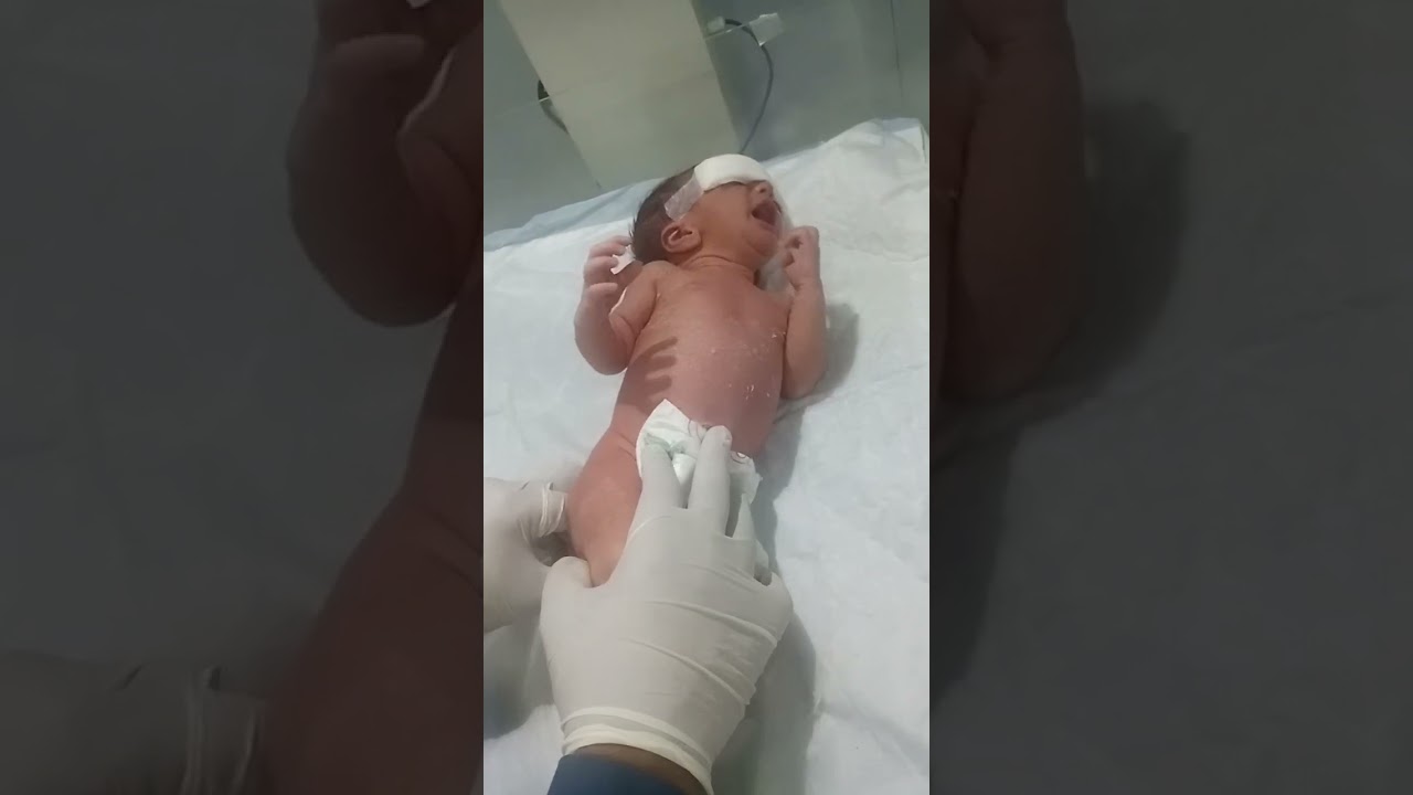 How to Insert Glycerin Suppository in a Baby for Abdominal Distension | Step-by-Step Nursing Guide