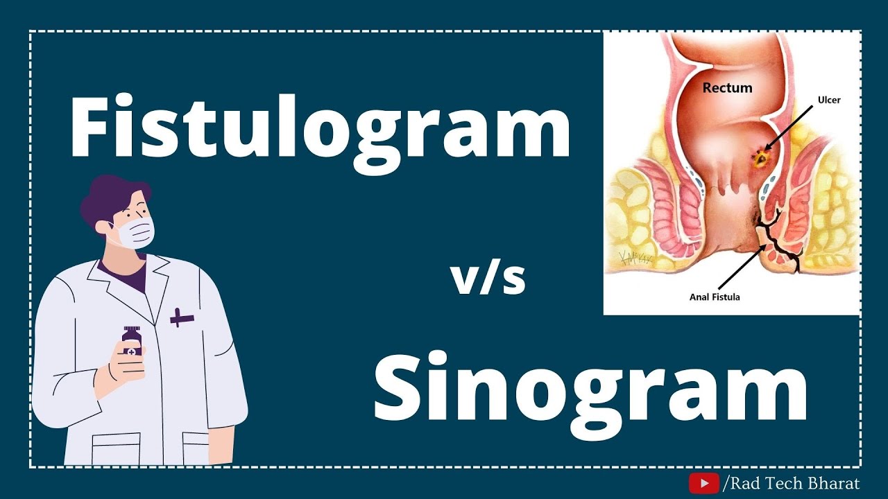 Fistulogram v/s Sinogram Radiology Procedure (Hindi /English)