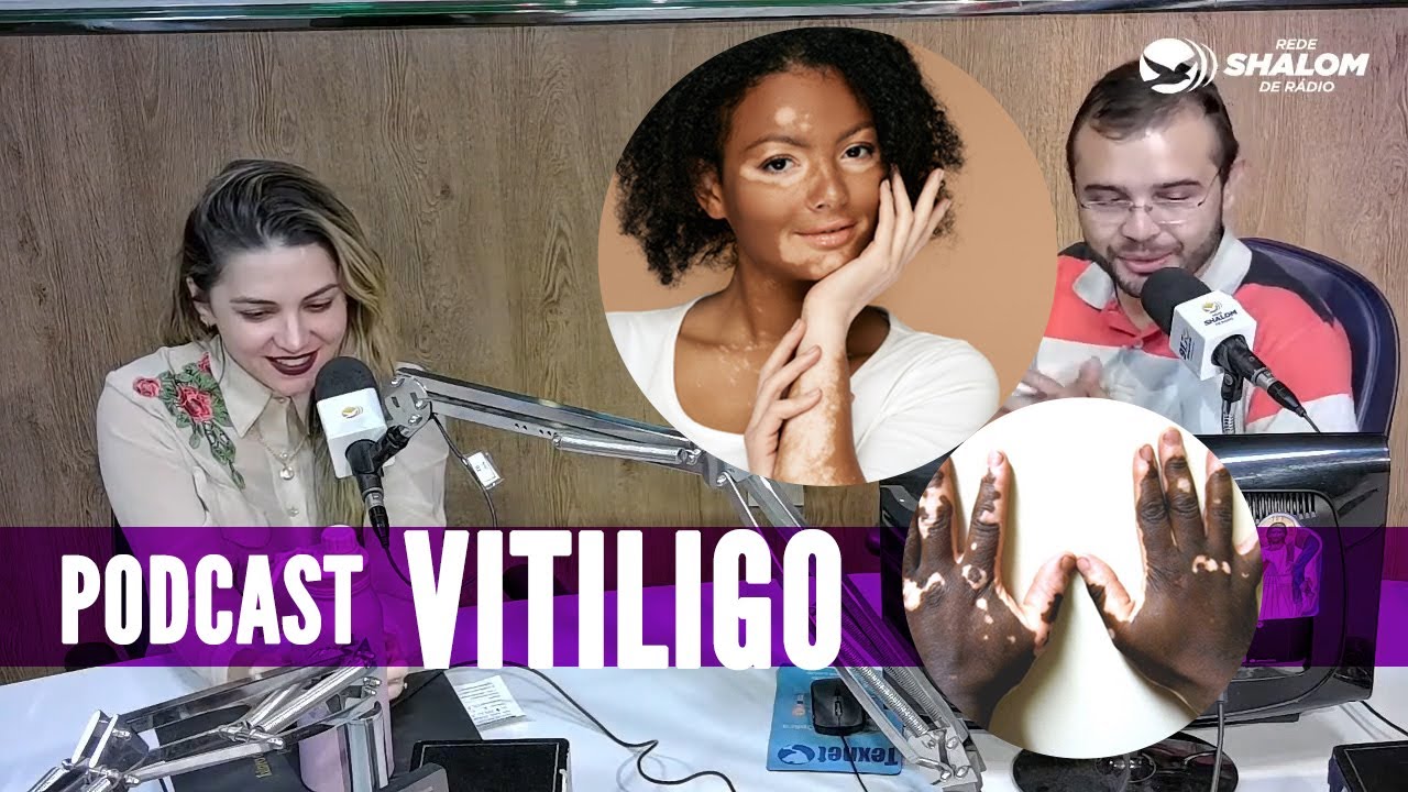 Podcast sobre VITILIGO | Vitiligo tem cura? Tratamento e Causas