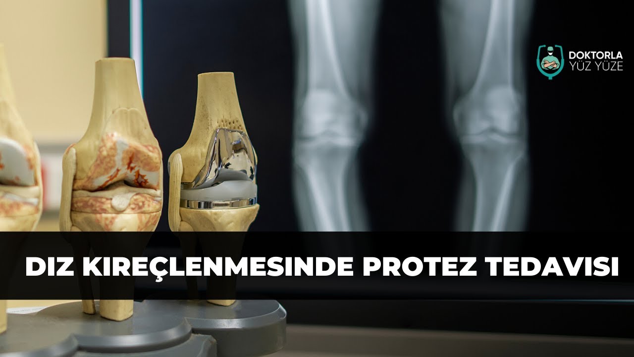 Diz Kireçlenmesi [Gonartroz] Tedavi Yöntemleri [Protez Ameliyatı]