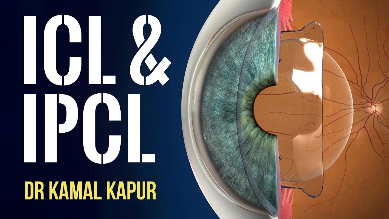 Dr Kamal Kapur | ICL & IPCL Session | Narayana Nethralaya | ICL eye surgery