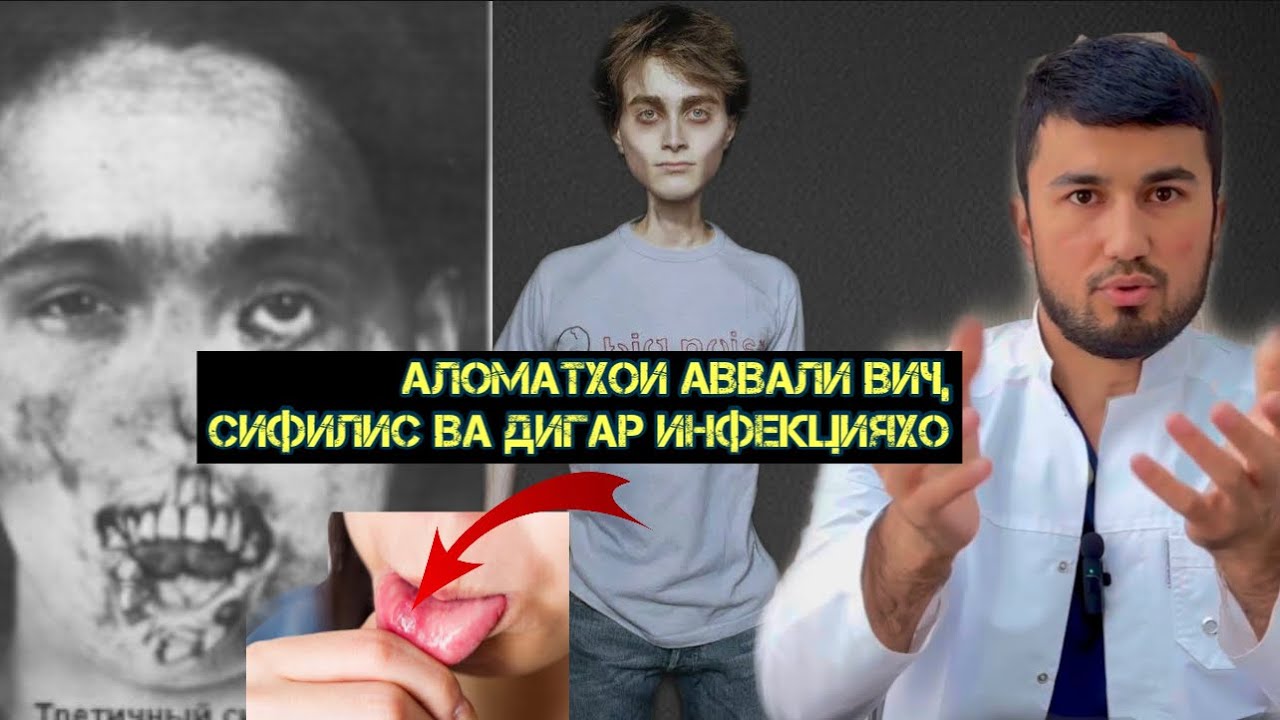 Аломатхои аввали ВИЧ, сифилис ва дигар инфекцияхое, ки ба тарики алокаи чинси мегузаранд.