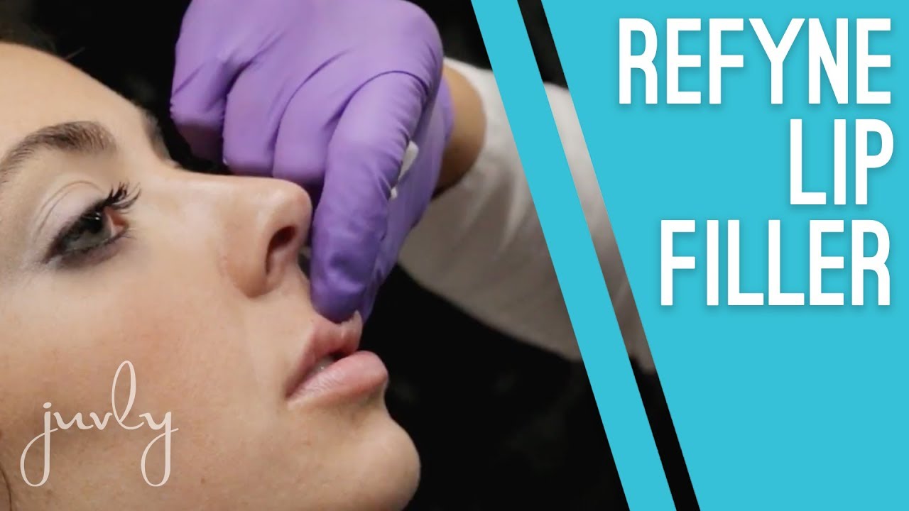 Restylane Refyne Lip Filler with Danielle