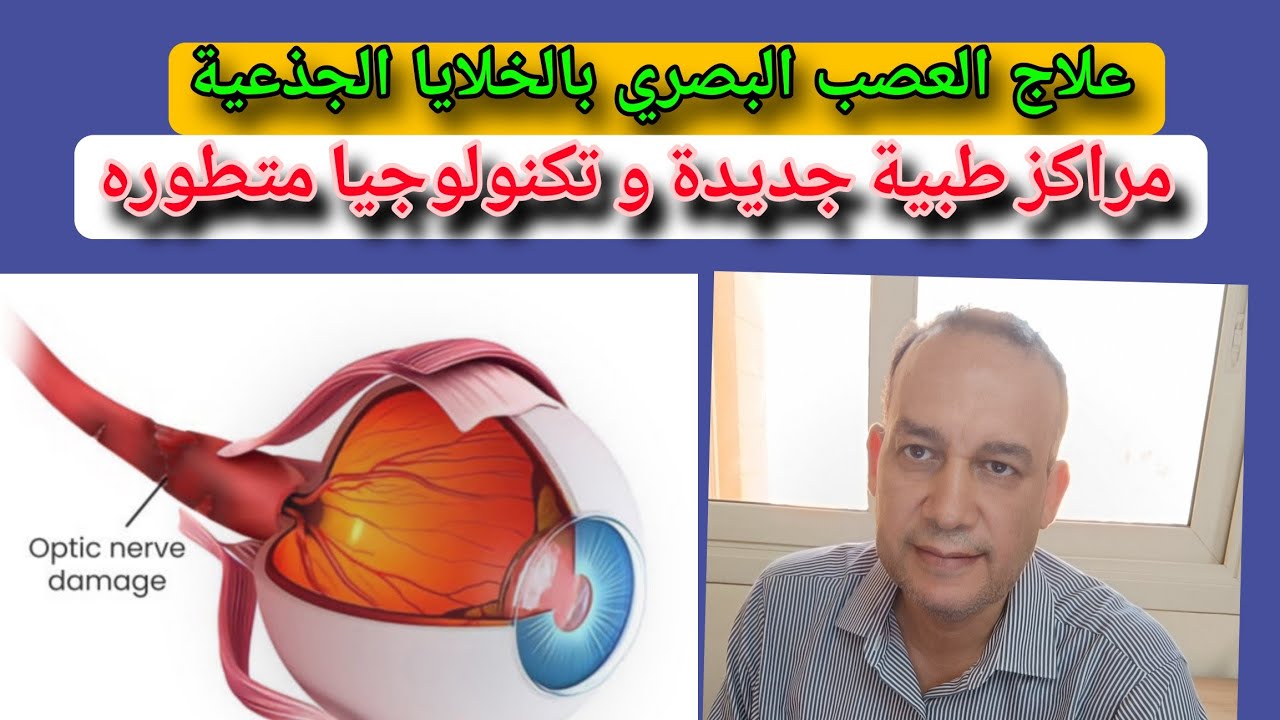 بالخلايا الجذعية مراكز حديثه لعلاج ضمور العصب البصري. التكلفه و الطريقه. الجلوكوما العشي الليلي....