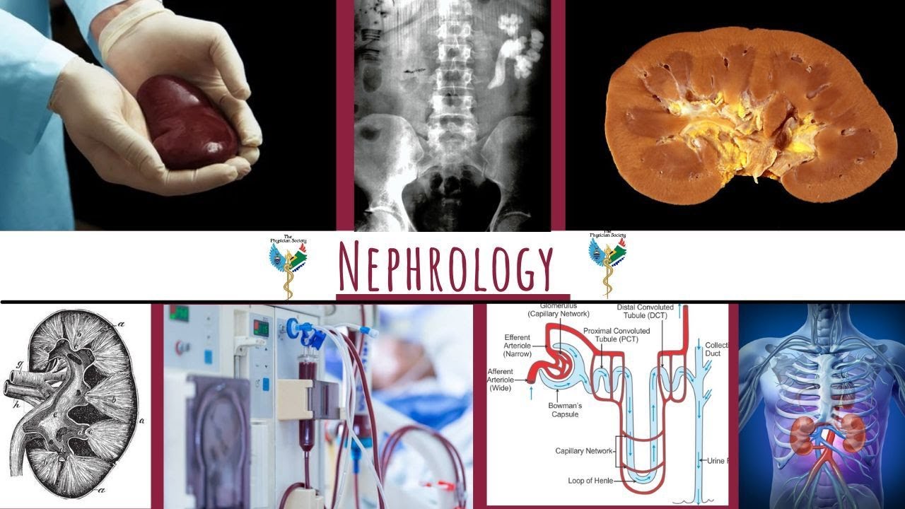 Physician Sub-specialty Series: Nephrology l The Wits Students' Physician Society
