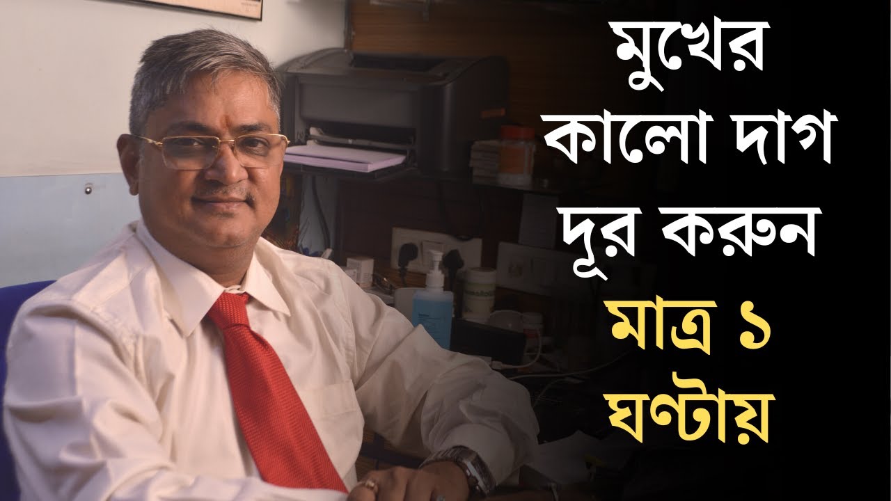 মুখের কালো দাগ দূর করুন মাত্র ১ ঘণ্টায় - মুখের কালো দাগের চিকিৎসা - মুখের কালো দাগ দূর করার উপায়