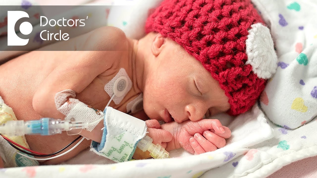 Guidelines for temperatures in NICU  - Dr. Chandra Kumar N of Cloudnine Hospitals