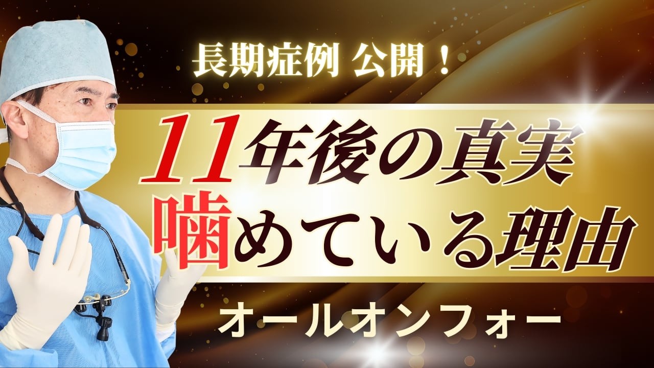 【オールオンフォー】歯がボロボロ・グラグラだった方が１１年経っても噛める喜び　実際の症例を紹介します