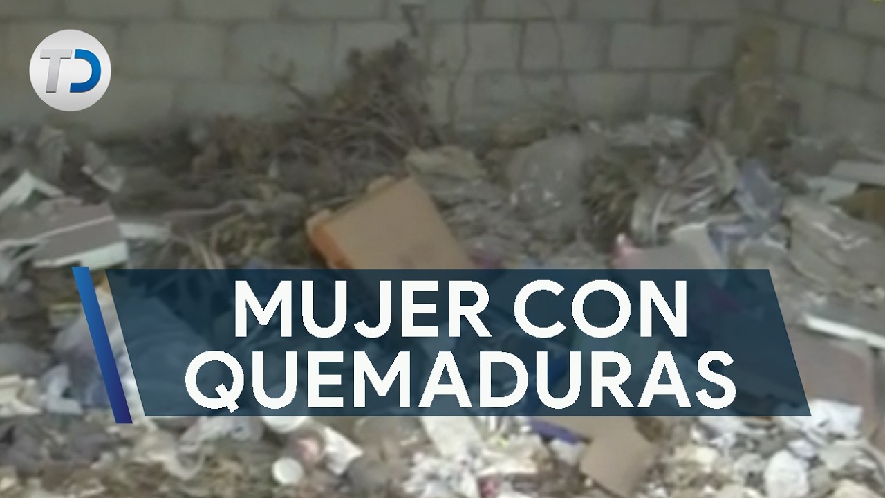 Mujer con quemaduras de tercer grado tras incendio; estaba dormida