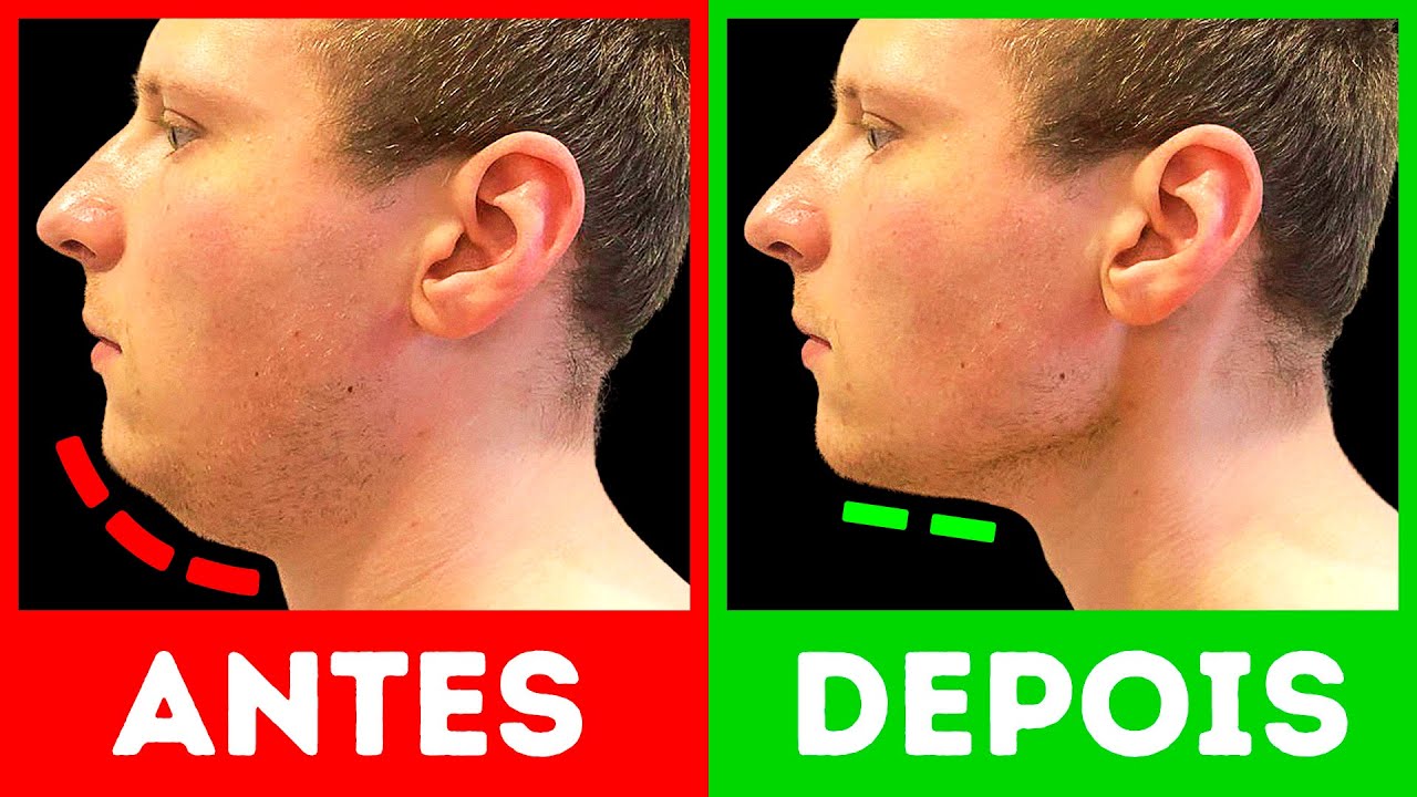 Treino de 5 minutos para obter um queixo definido e másculo
