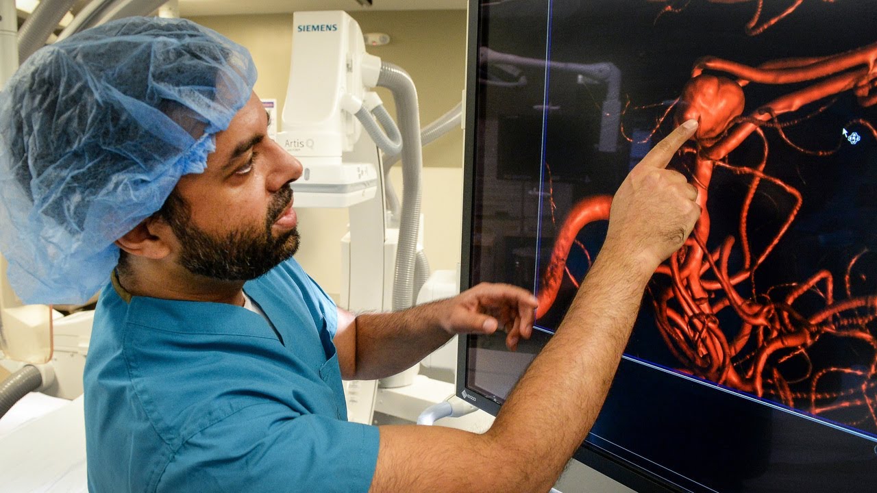 Procedure aimed to help aneurysm patients with a less-invasive and more effective solution