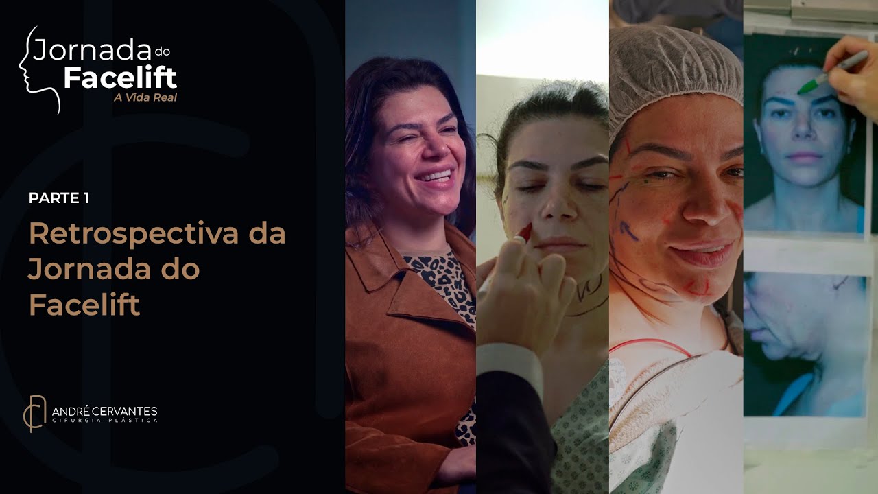 Jornada do Facelift - A vida real | Retrospectiva da Jornada do Facelift - Parte 1