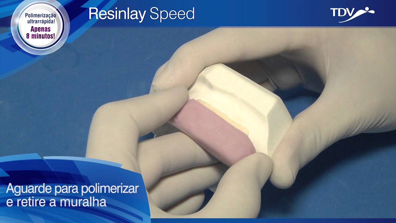 Resinlay Speed - Confecção de Provisórios Técnica Muralha