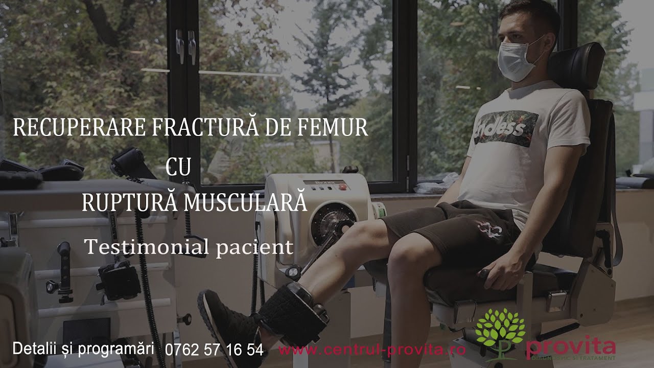 Recuperare medicala dupa fractura diafiza femurala dreapta - Centrul de Recuperare Medicala Provita