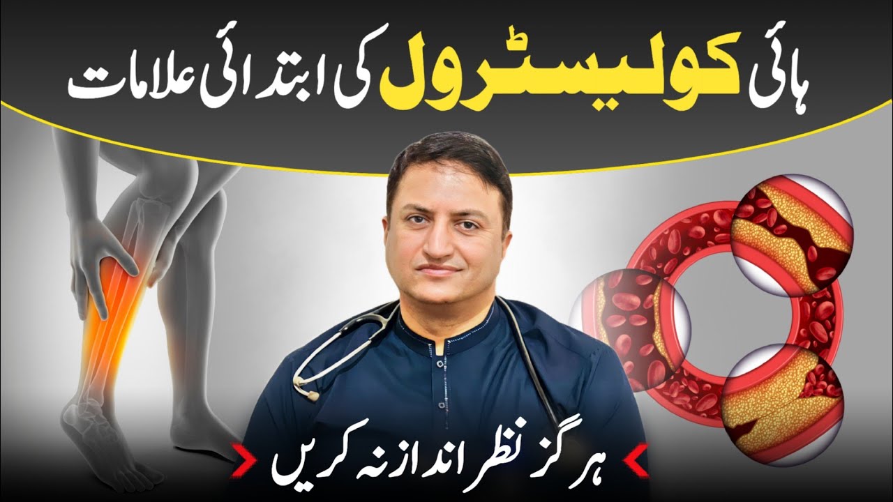 High Cholesterol kee ibtadai alaamat - Hargiz nazar andaz na karien