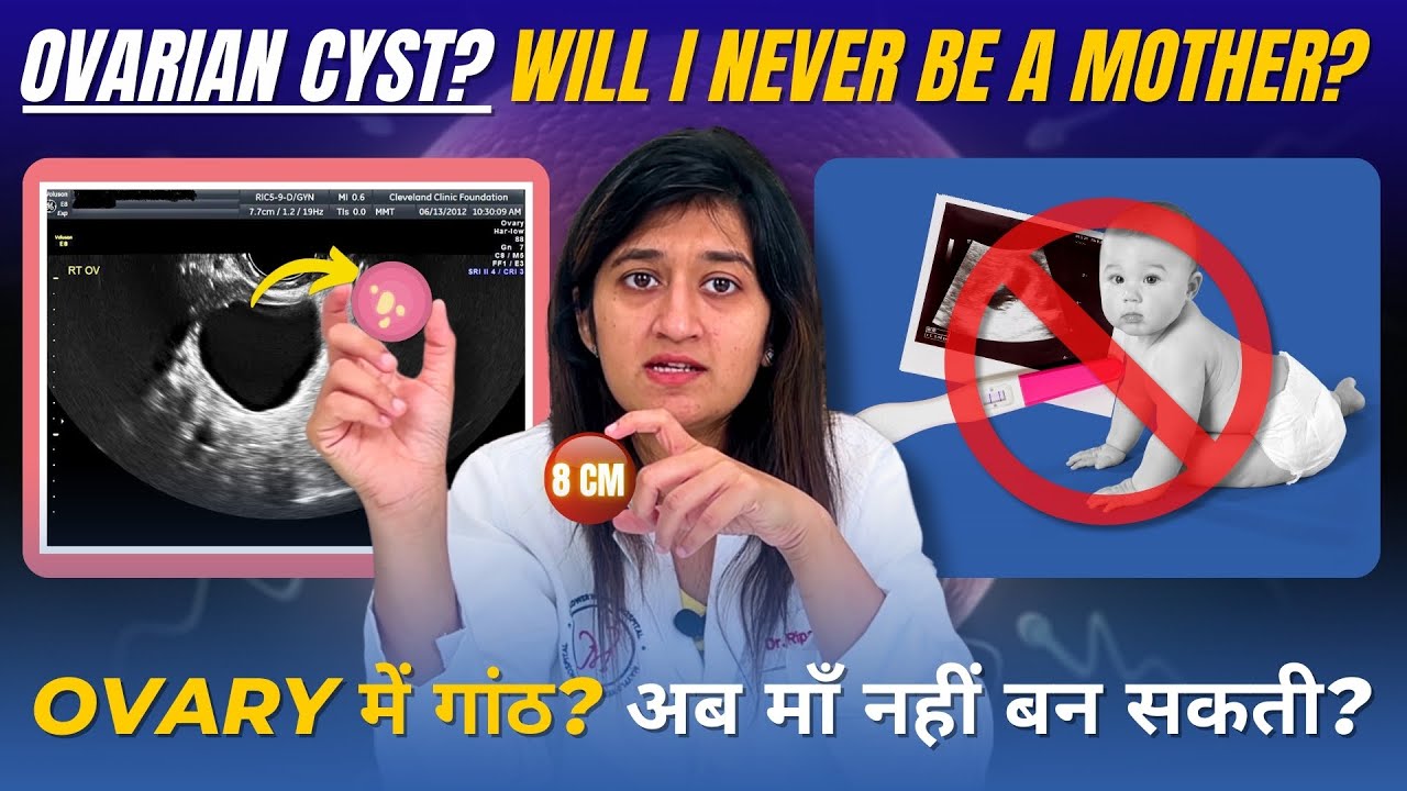 Ovarian Cyst Ke Saath Pregnancy Possible Hai? Sab Kuch Jo Aapko Jaanna Chahiye! #ovariancysts #ivf