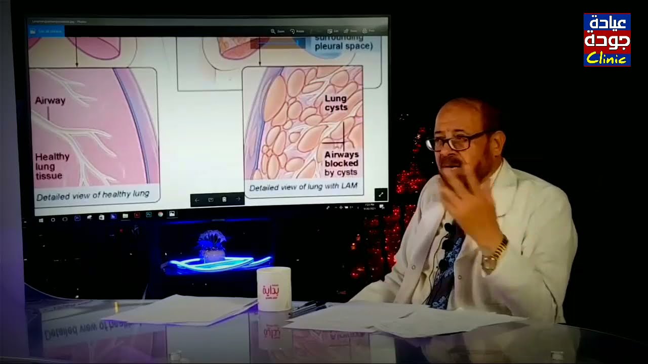 تكيس الرئة | دكتور جودة محمد عواد | دكتور جودة محمد عواد
