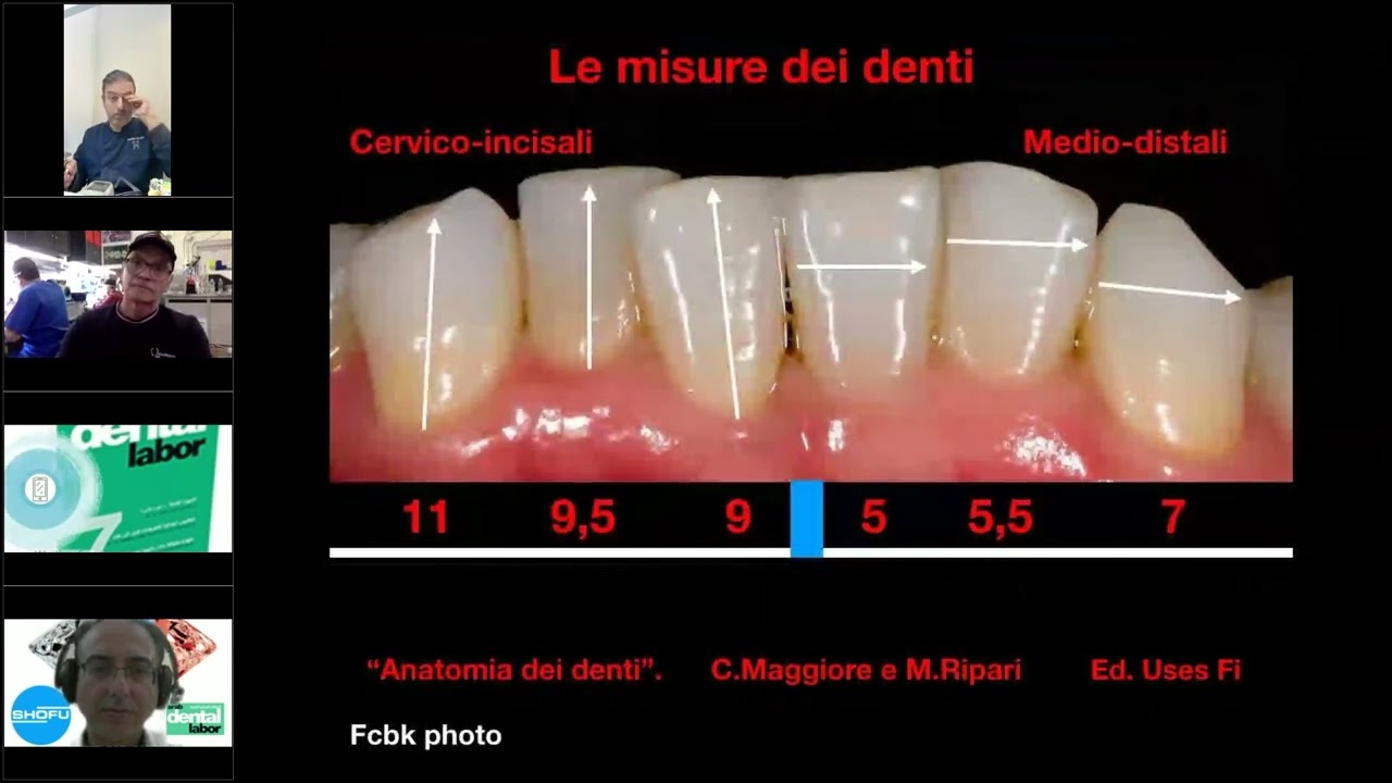 Esthetic Metal Free Solutions