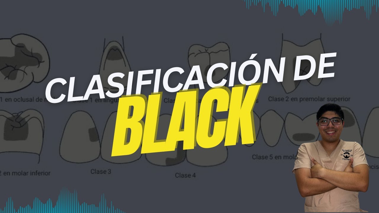 CLASIFICACIÓN DE BLACK