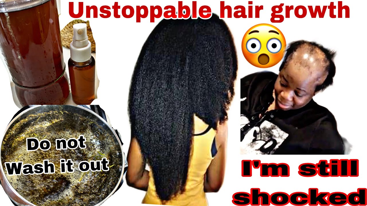 I’M STILL SHOCKED!😱 MIX OREGANO, ROSEMARY & CLOVE UR HAIR & BALDNESS WILL NEVER STOP GROWING