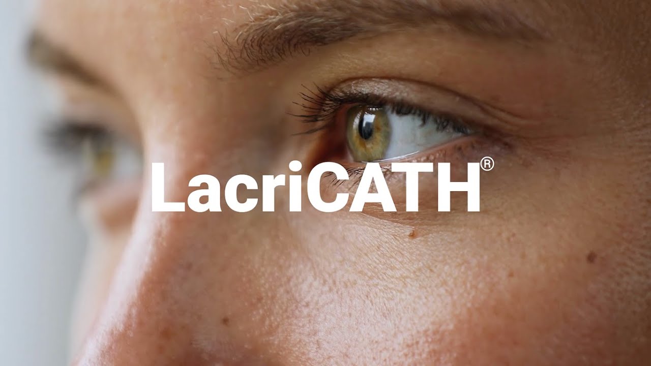 LacriCATH&reg;: A better treatment option for chronic tearing