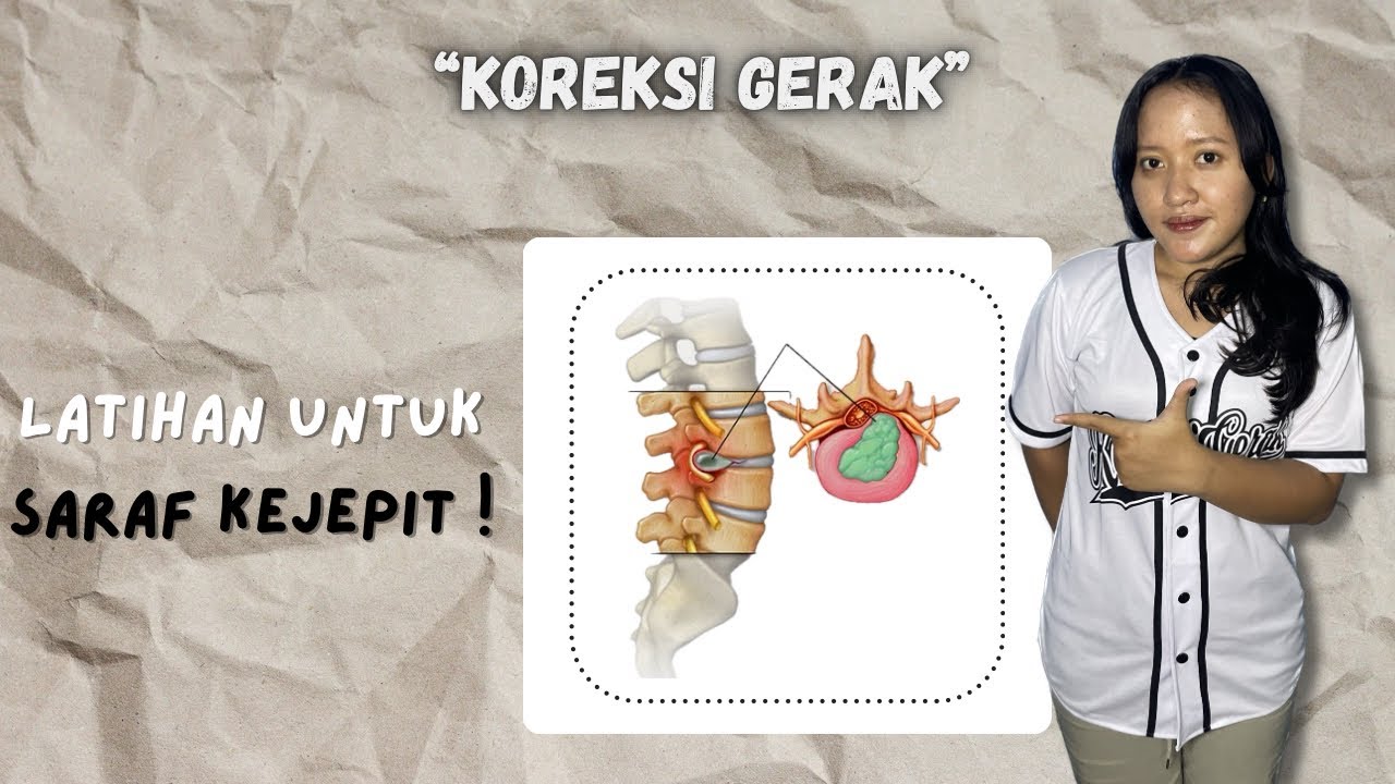Cara mengatasi Saraf Terjepit pada Pinggang “HNP LUMBAL” #movewell 
