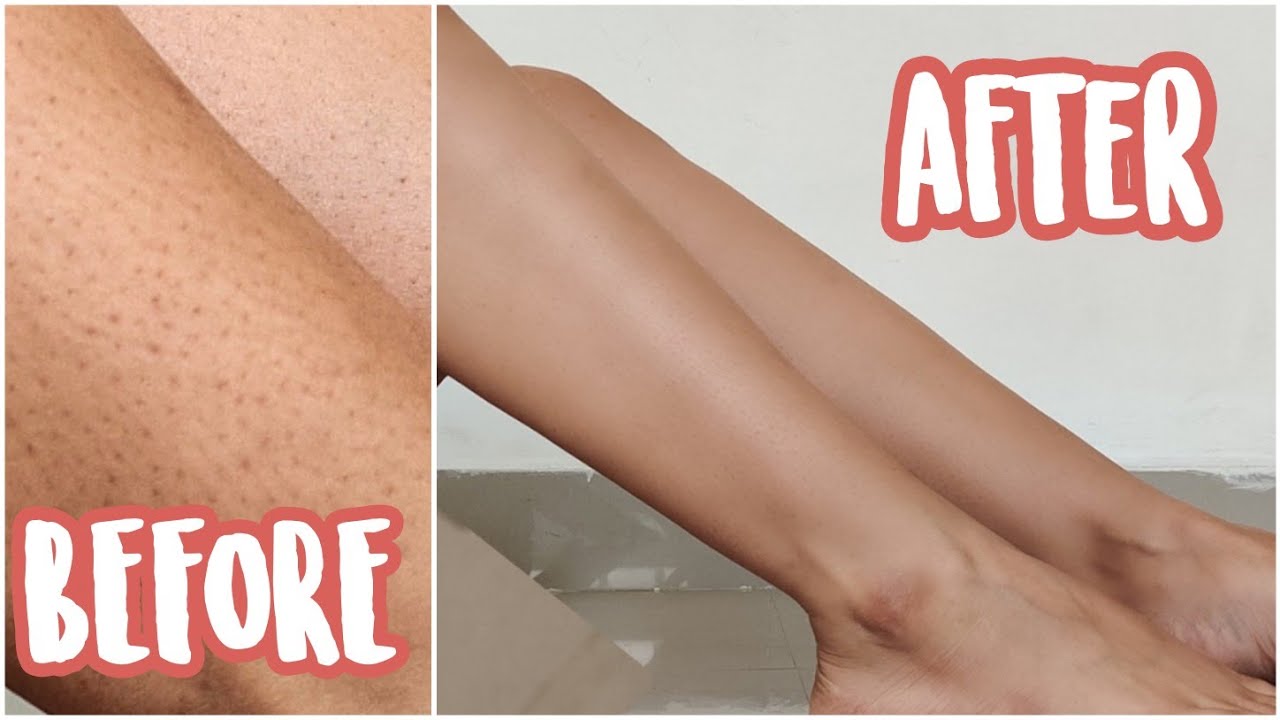 How to get rid of strawberry legs + ingrown hair | my shaving routine