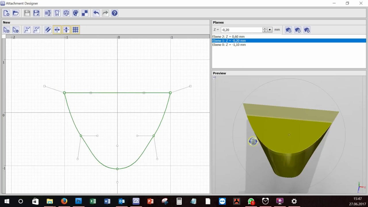 OnyxCeph³™ Option Attachment Designer