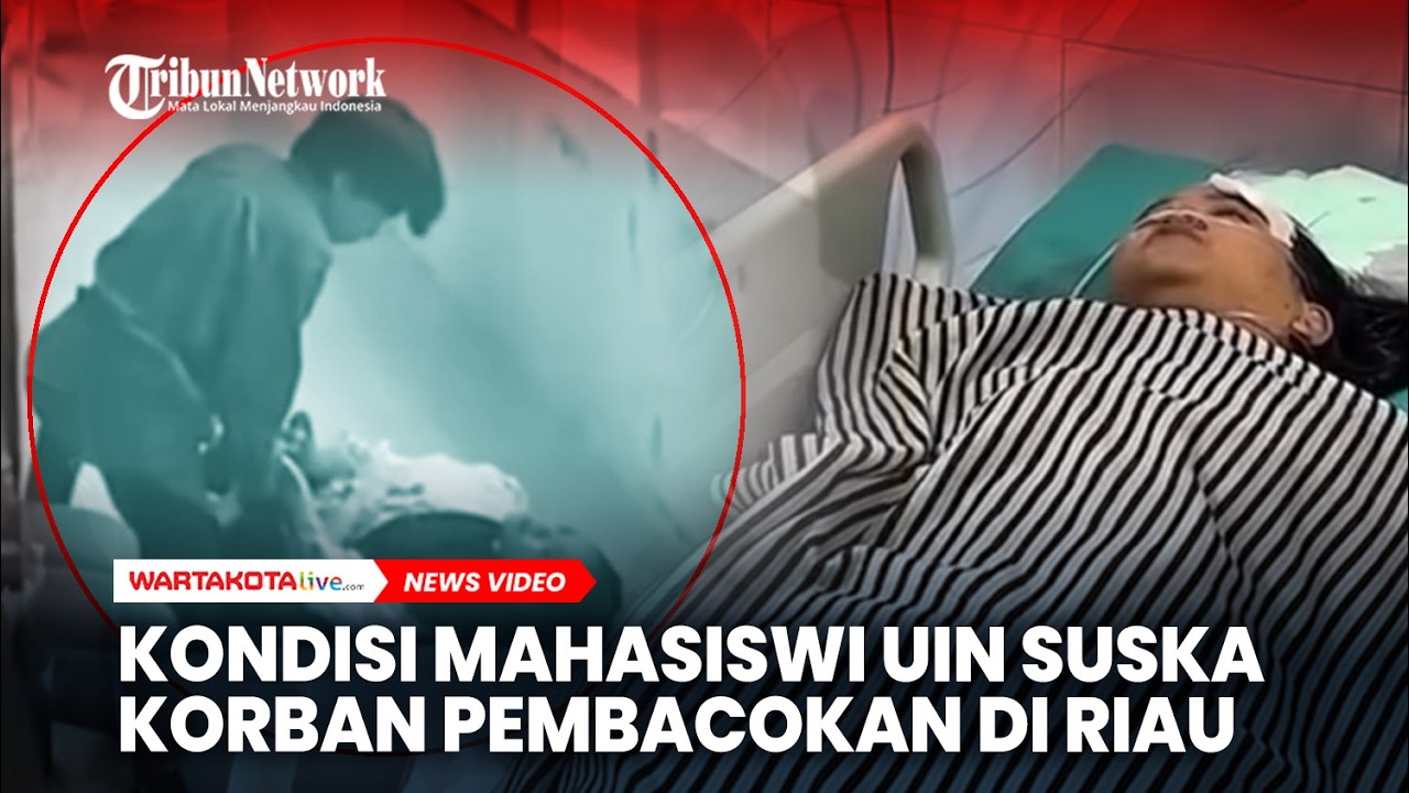 Kondisi Mahasiswi UIN Suska Korban Pembacokan di Riau