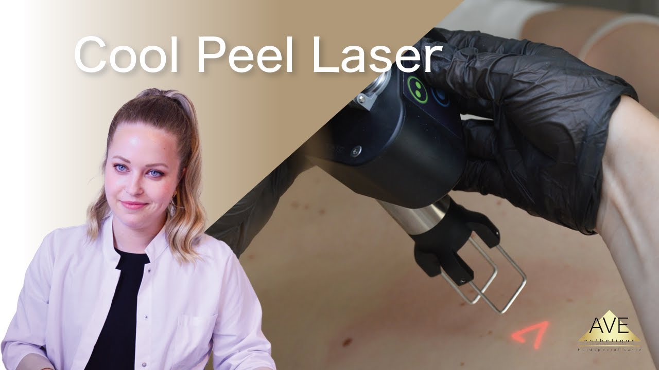 Get smooth met de Cool Peel | Ave Huidkliniek