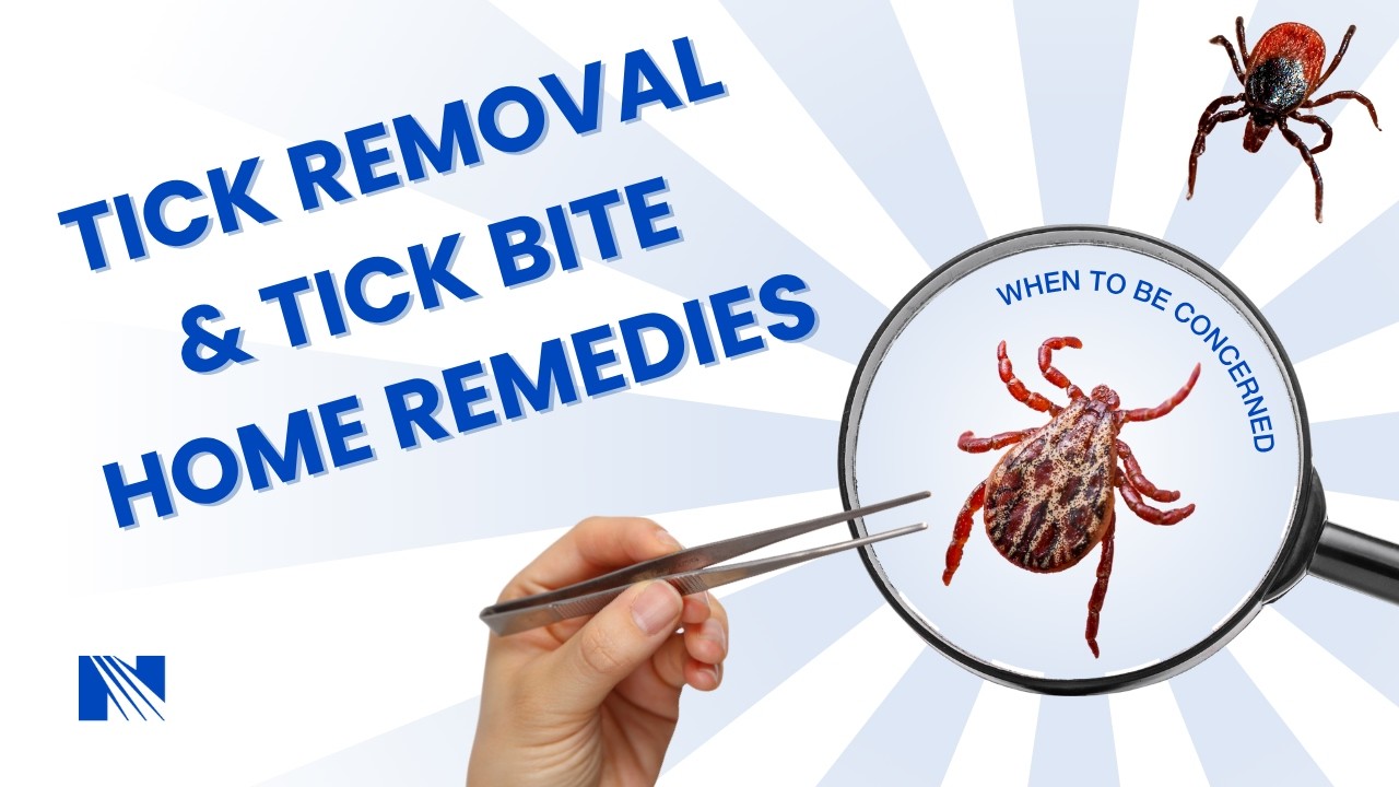Tick Removal and Tick Bite Home Remedies